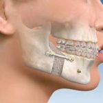 مرکز جراحی محدود فارابی قم